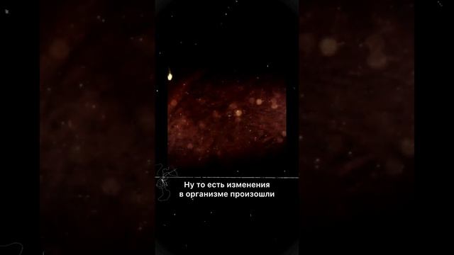 Эта простая вещь могла спасти жизнь Мопсику.