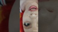 Прокол-септум
