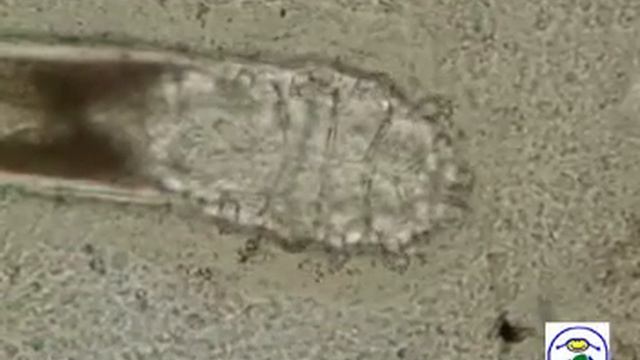 Demodex