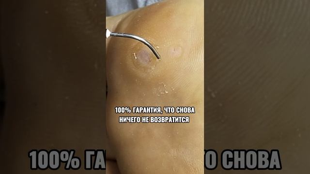 Работа без боли, слез с гарантией