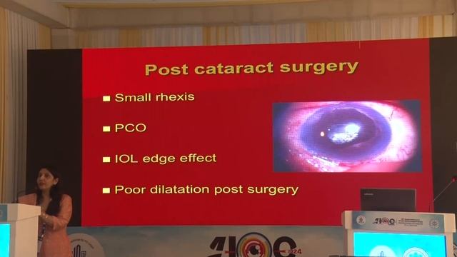 AIOC2024 - GP166 - Indirect Ophthalmoscopy