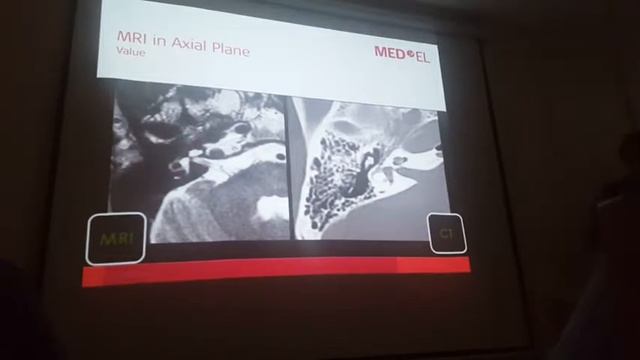 temporal radiology med el 4