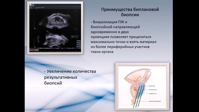 Современные и потенциальные возможности в ультразвуковой визуализации