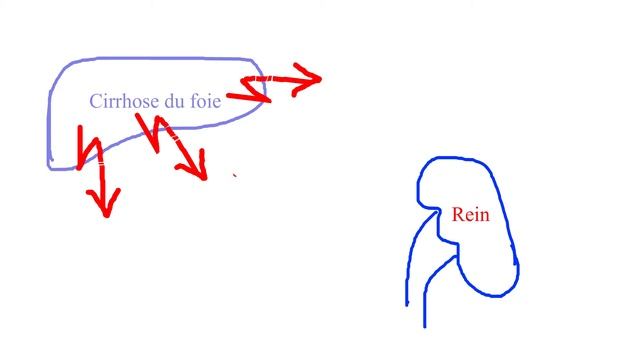 Syndrome hépatorénal