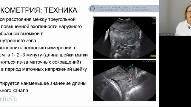 5.1. Лекция. Шейка матки