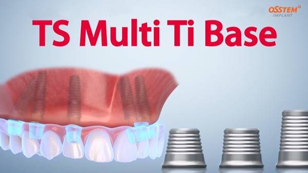 TS Multi Ti Base / Титановые основания