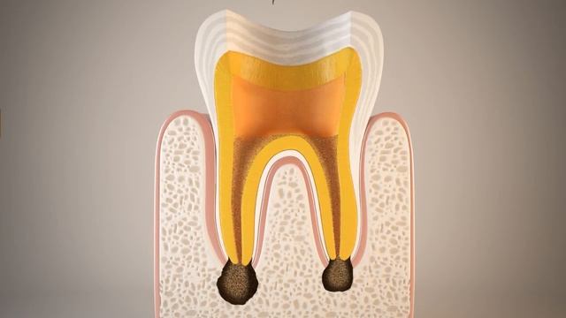 Endodontija - Dantų šaknų Kanalų Gydymas