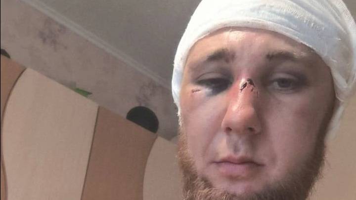 В Красноярском крае шакалы с молотками напали на участника СВО Тимофея Матвеева !!!
