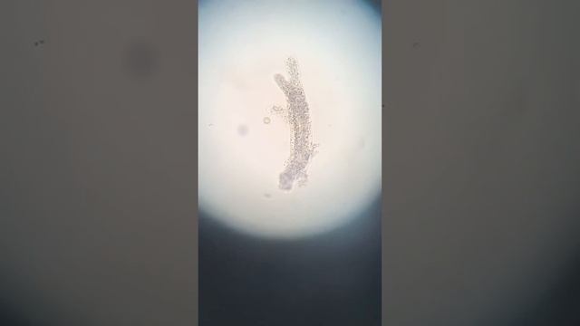Amoeba under a microscope