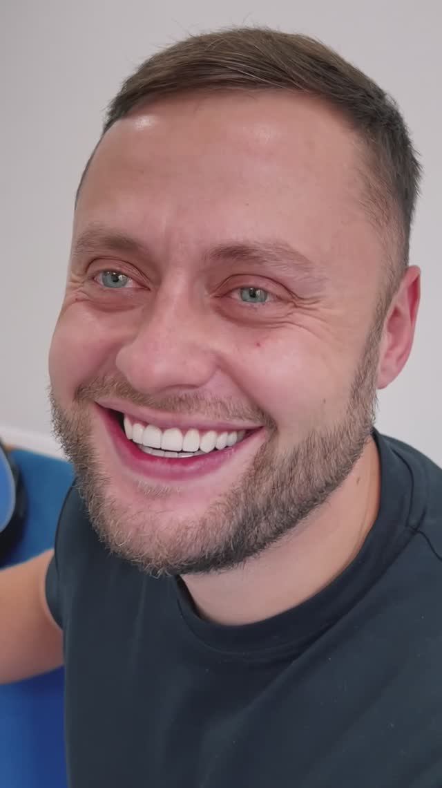 ВИНИРЫ + КОРОНКИ E-max