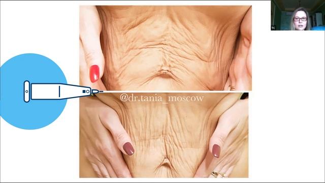 Запись вебинара: Круглый стол с успешными косметологами