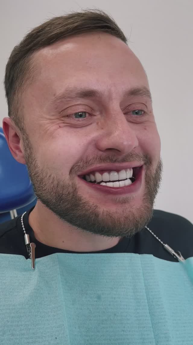 УСТАНОВКА ВИНИРОВ