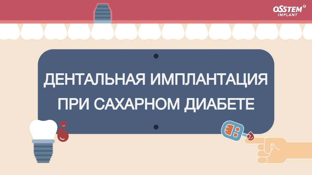 Можно ли ставить имплантаты при сахарном диабете?