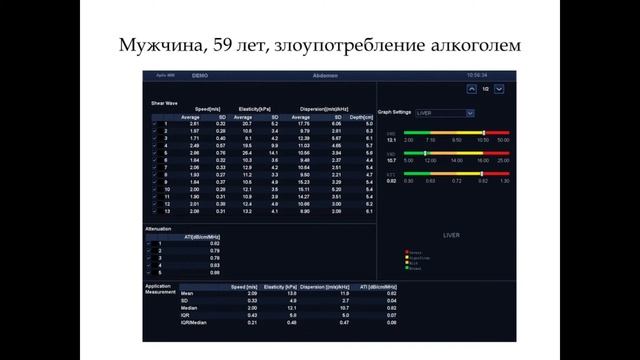 Мультипараметрическое ультразвуковое исследование печени на Aplio i800 Зубарев Александр Васильевич