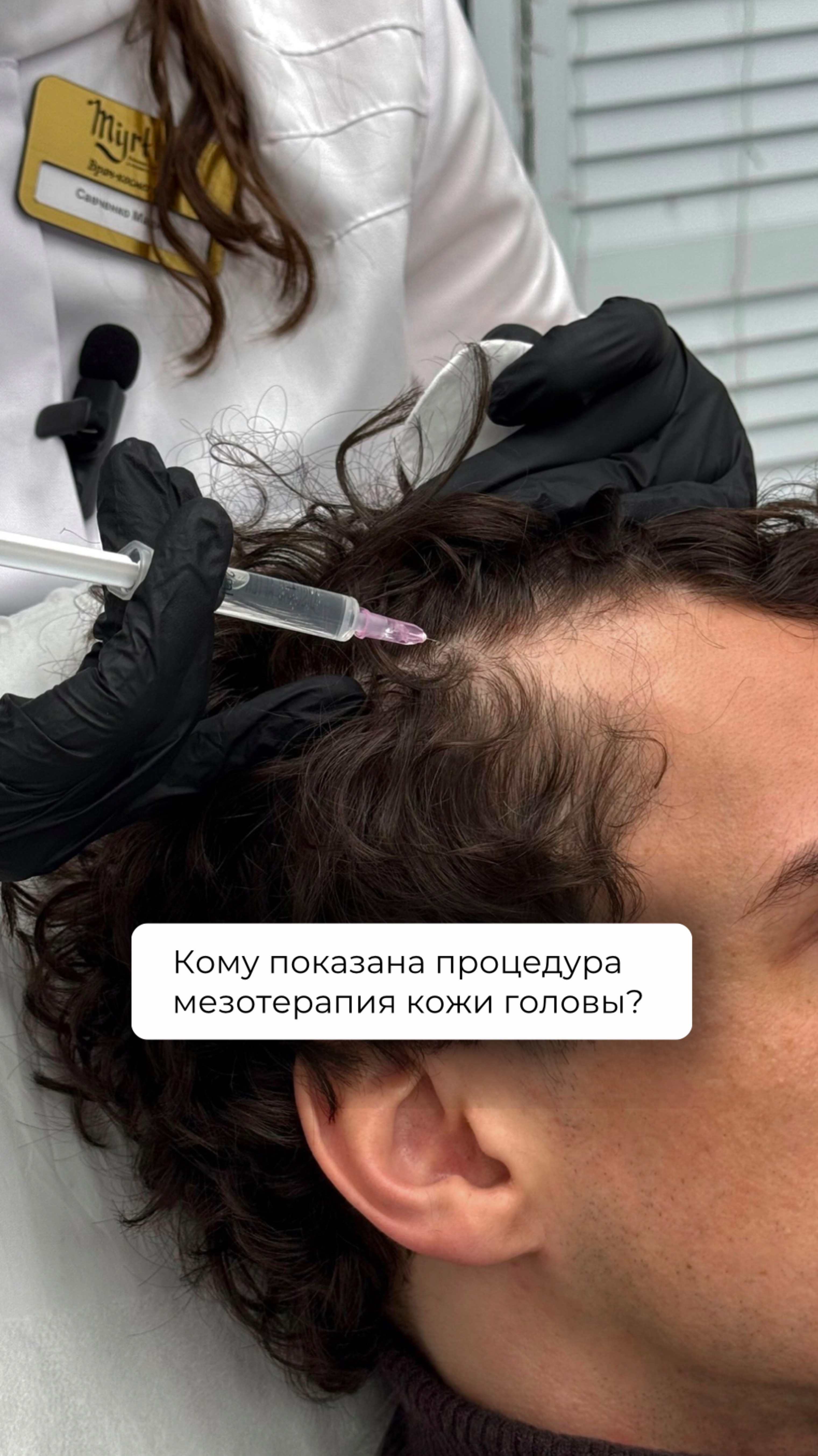 Кому показана процедура мезотерапии кожи головы?