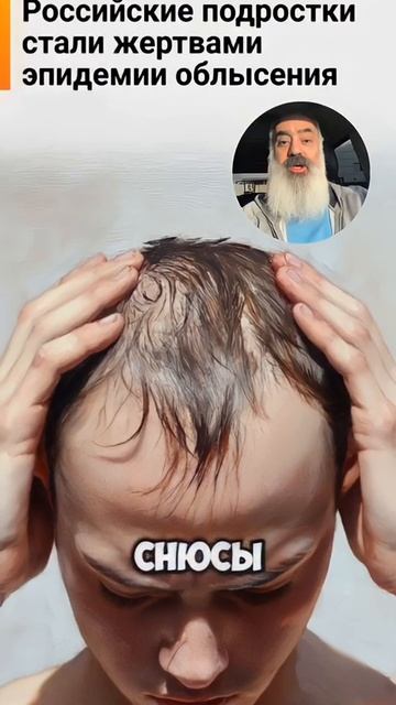👦⚡️ Лысина в 15?