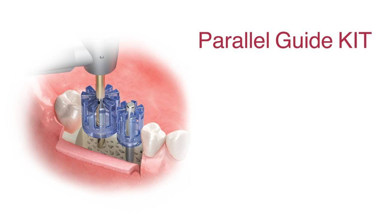 Parallel Guide KIT Протокол Работы