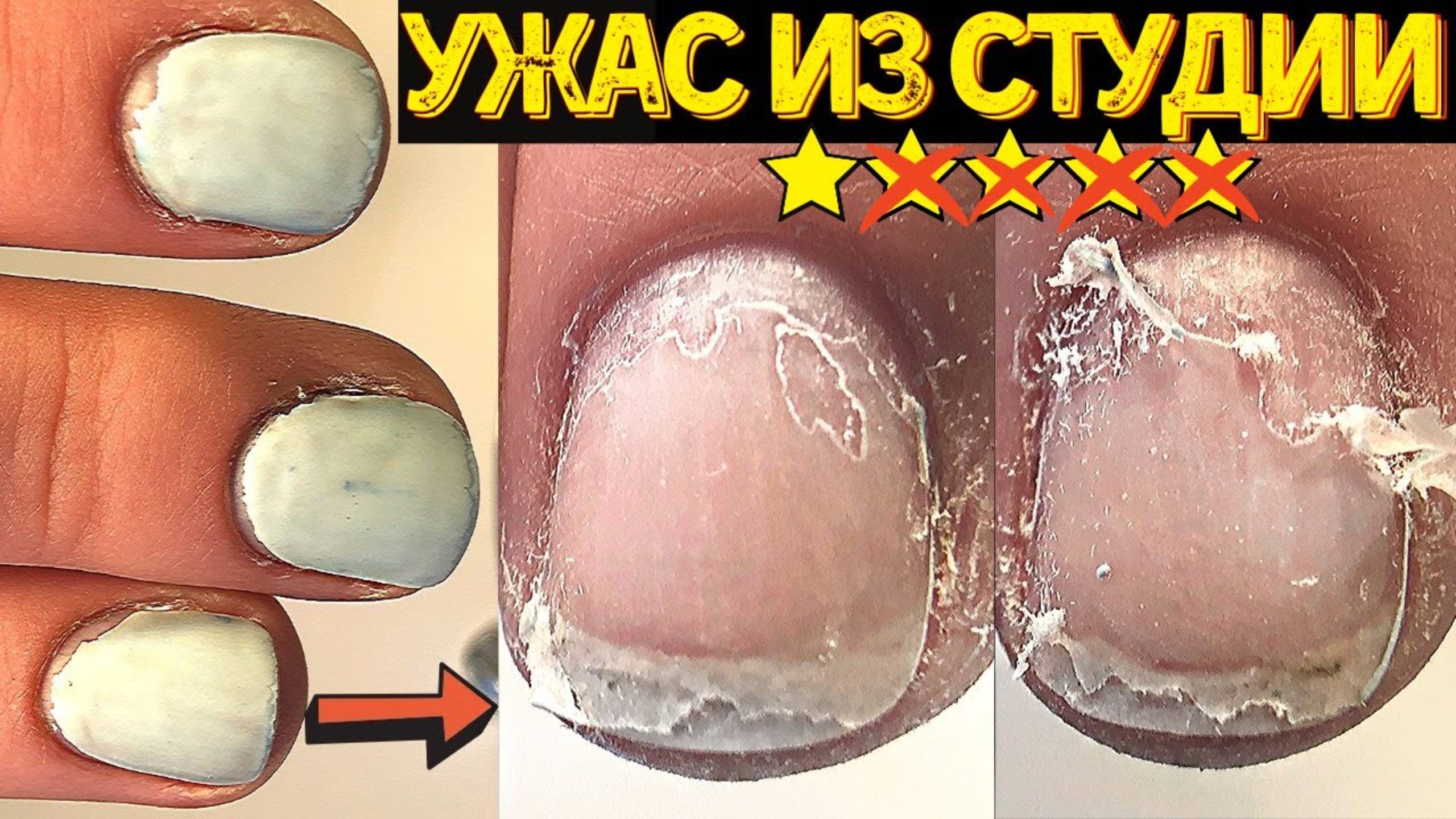 Вот это ТРЭШ маникюр из студии маникюра⛔ Как так можно убивать ногти? Покрытие гель лак