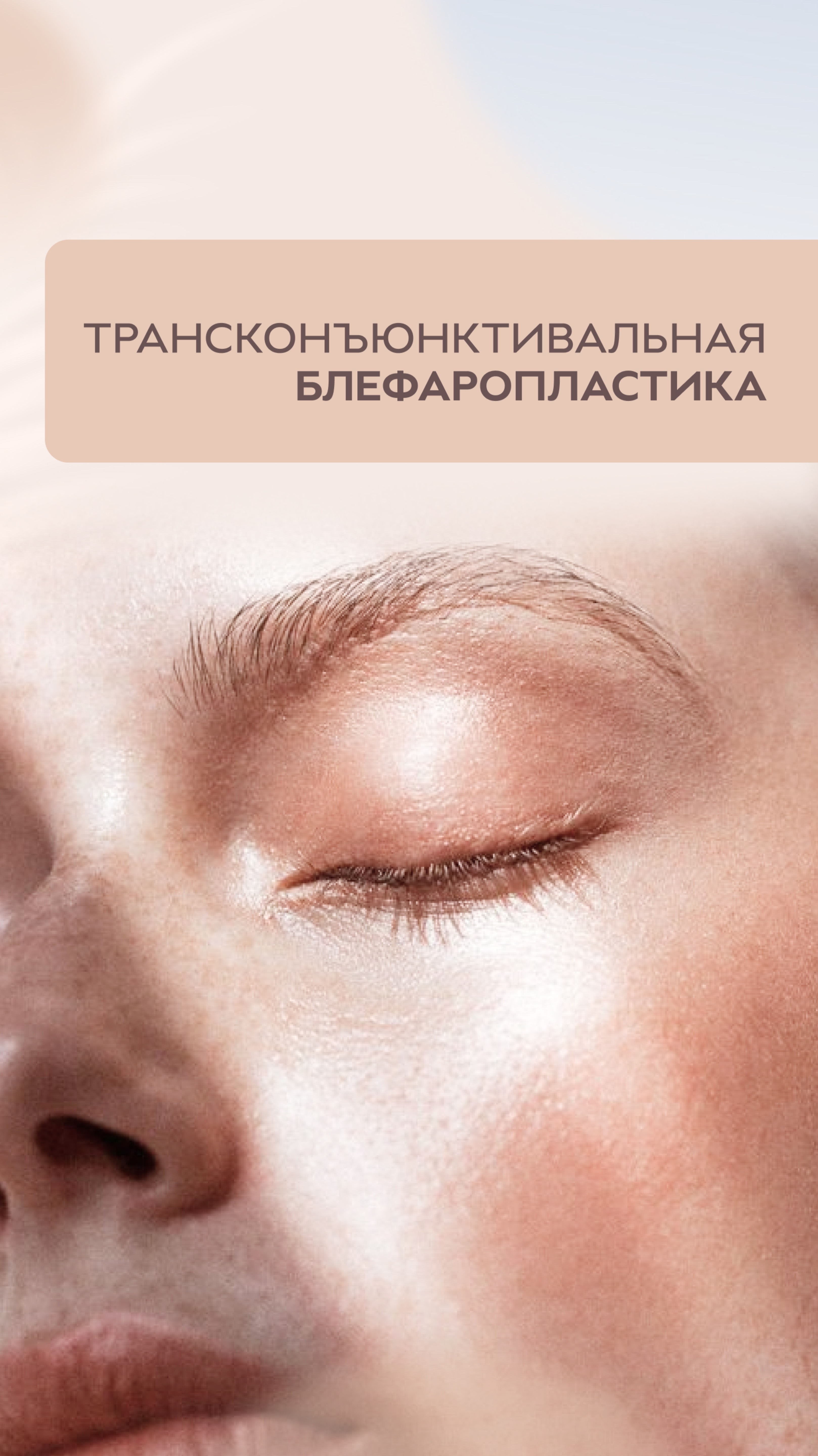 Трансконъюнктивальная блефаропластика.