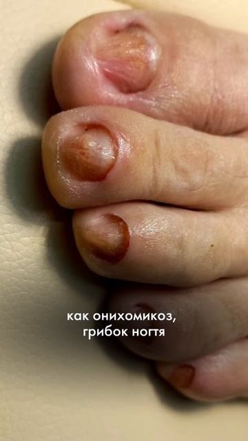 Если у Вас есть эти симптомы, то пора к подологу!