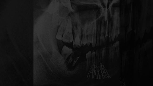 Sud sovesti (feat. Vólan)