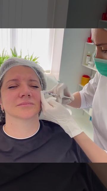 💭 Что такое ботокс и как он работает?