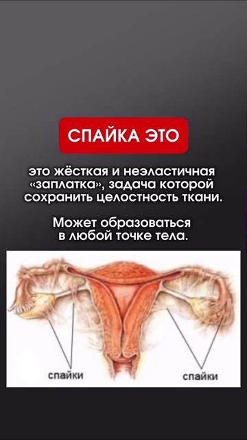Что делать со спайками:👇