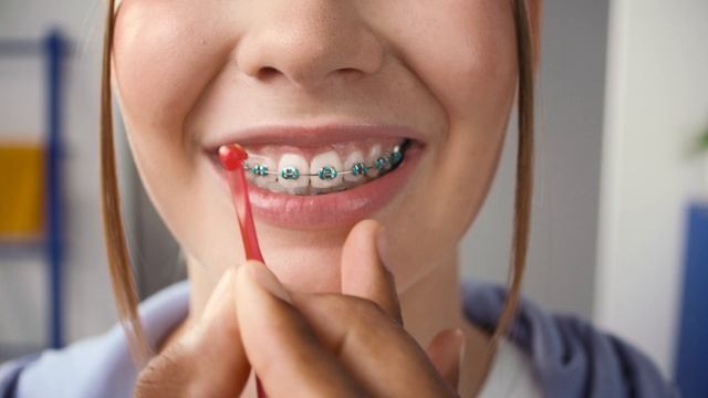 Межзубные ершики для обладателей брекетов