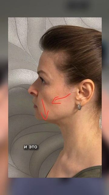 Три мышцы, которые старят лицо