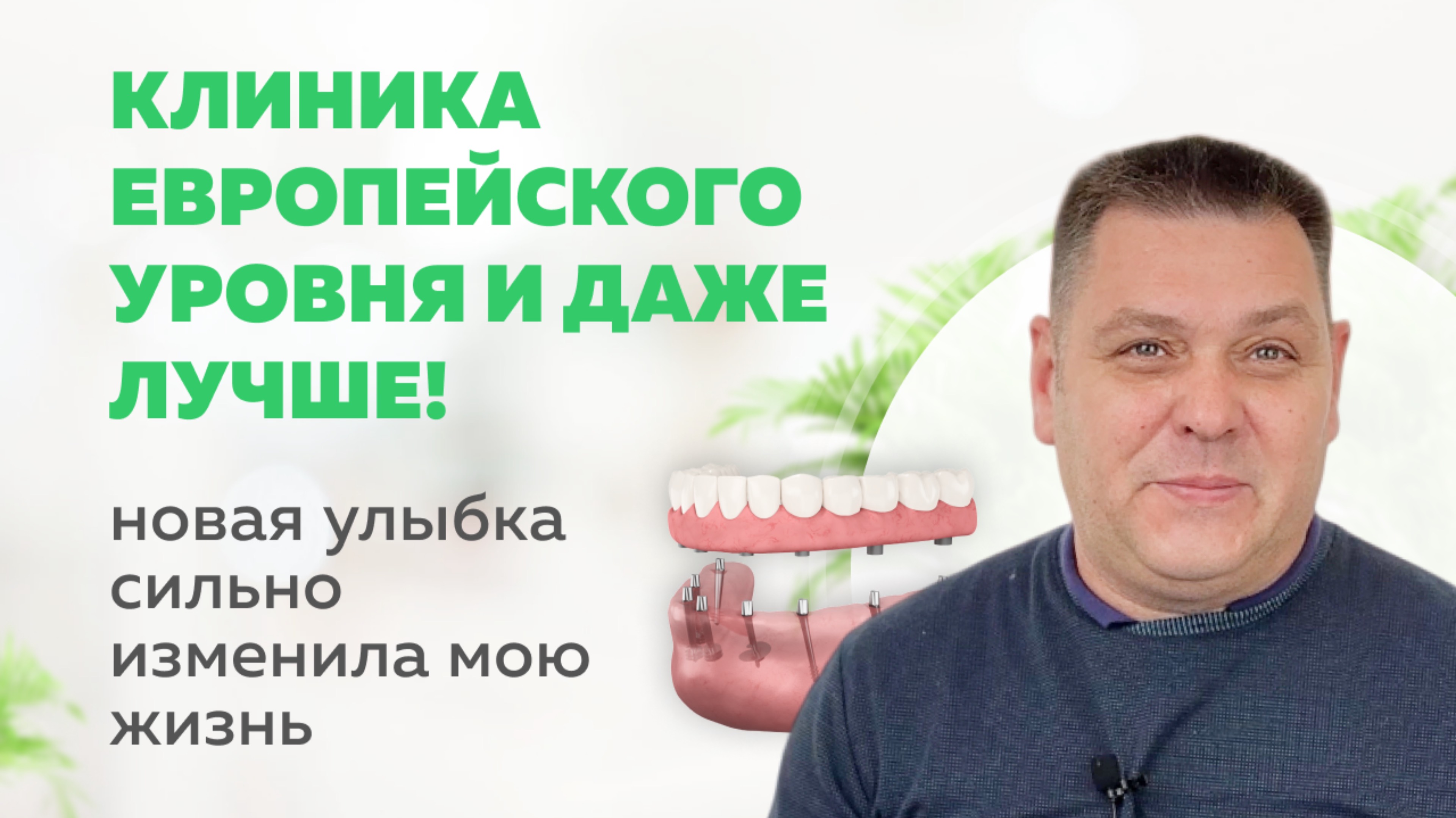 Новая улыбка всего через несколько дней |
Стратегическая имплантация в клинике Мандарин