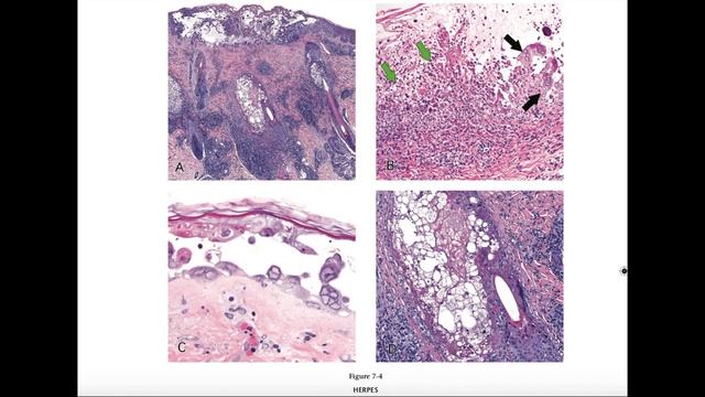 First look at my new textbook!!! Survival Guide to Dermatopathology