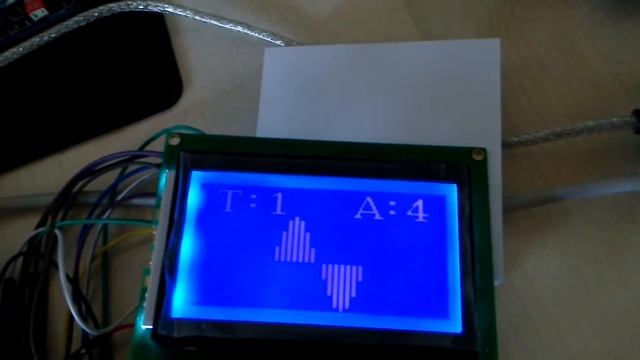 ATM12864D LCD Display Interface