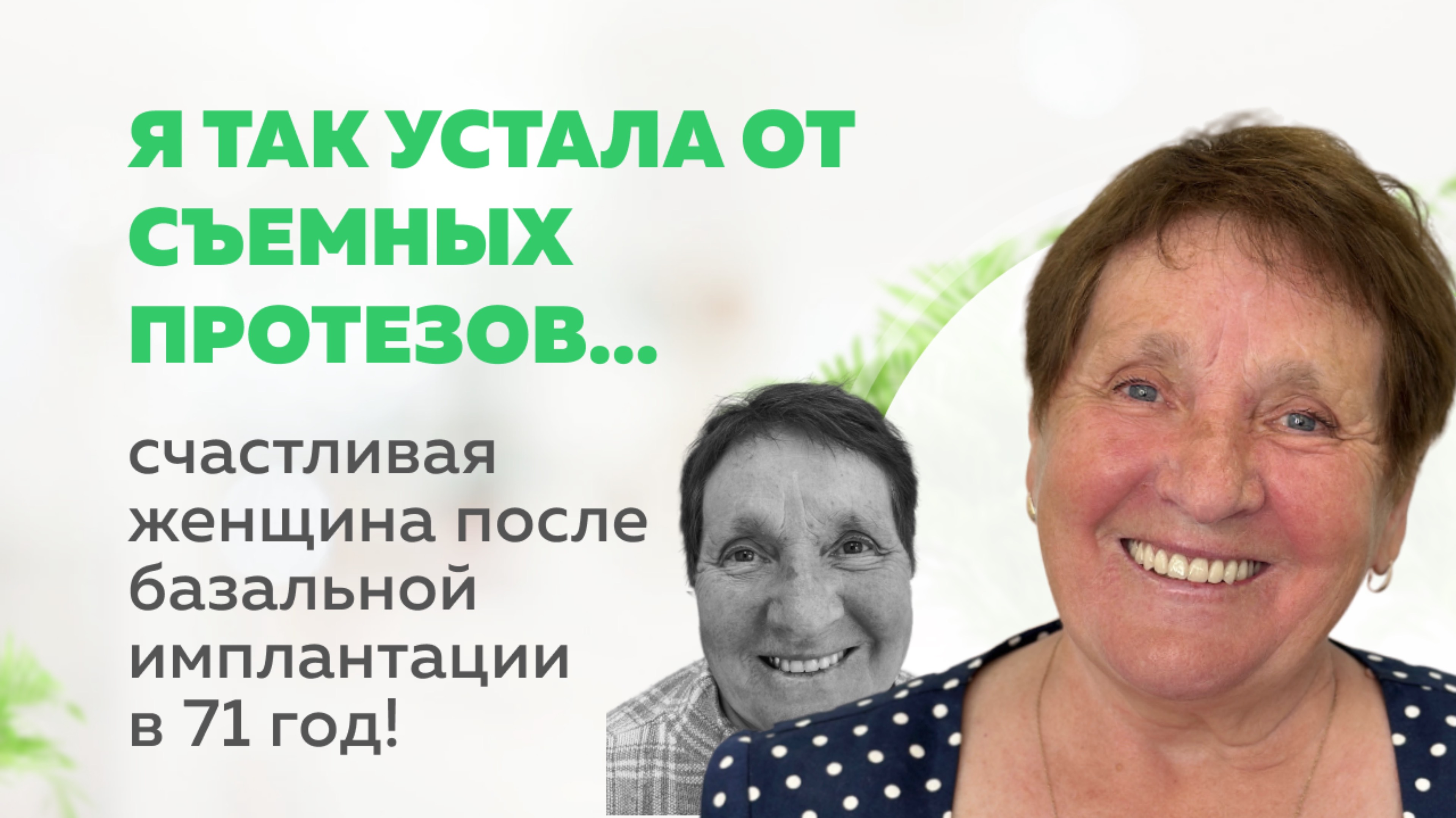 «Я так устала от съемных протезов!» | Клиника Мандарин Стратегическая имплантация во Владимире