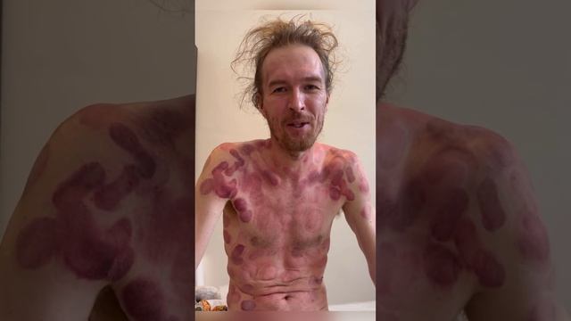 Диагностика и первый прием.