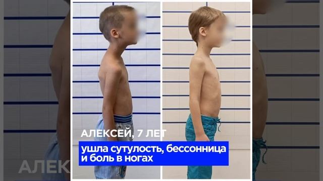 Сутулость, зажалось в шейном отделе позвоночника, боли в ногах, пояснице и плечах - как  лечить?
