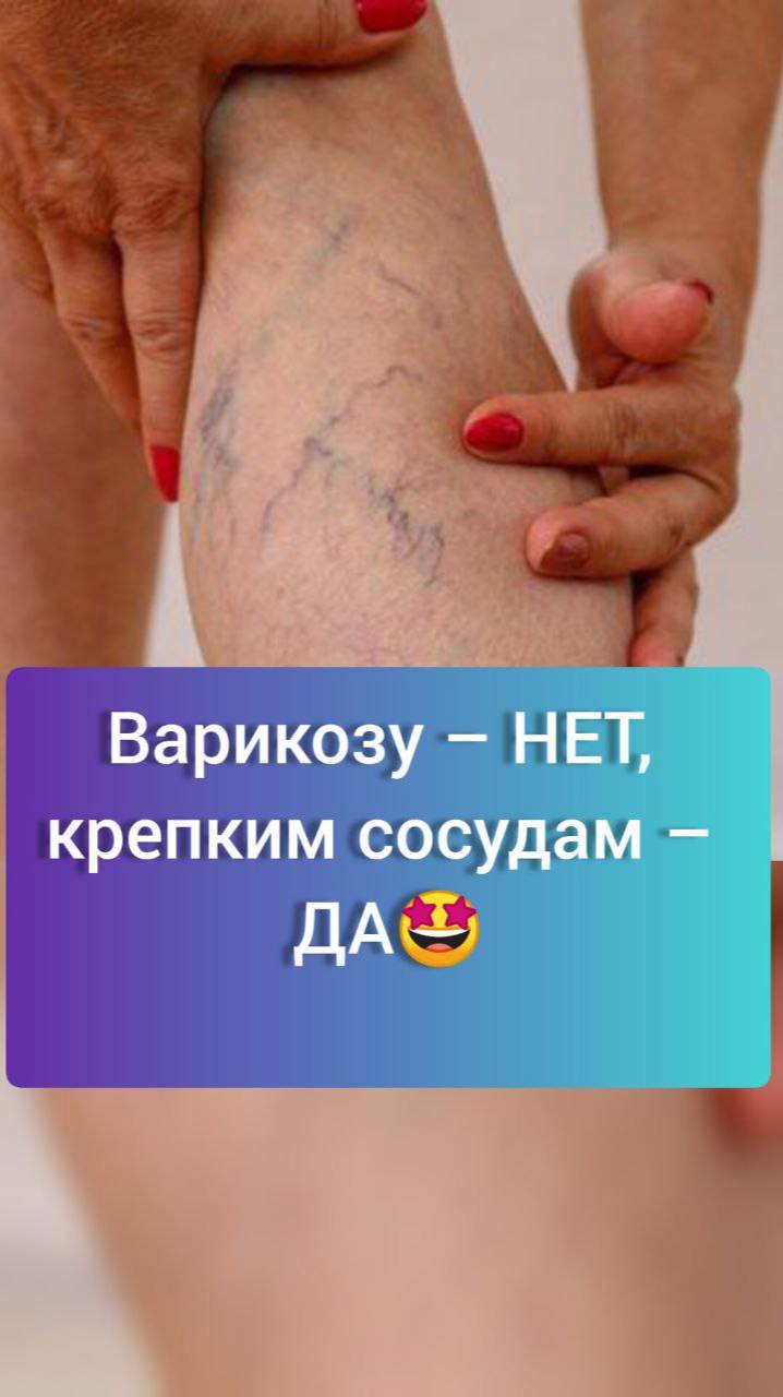 Пиши "Варикоз" и я расскажу, чем смогу тебе помочь