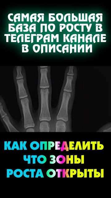31. Как определить что зоны роста открыты