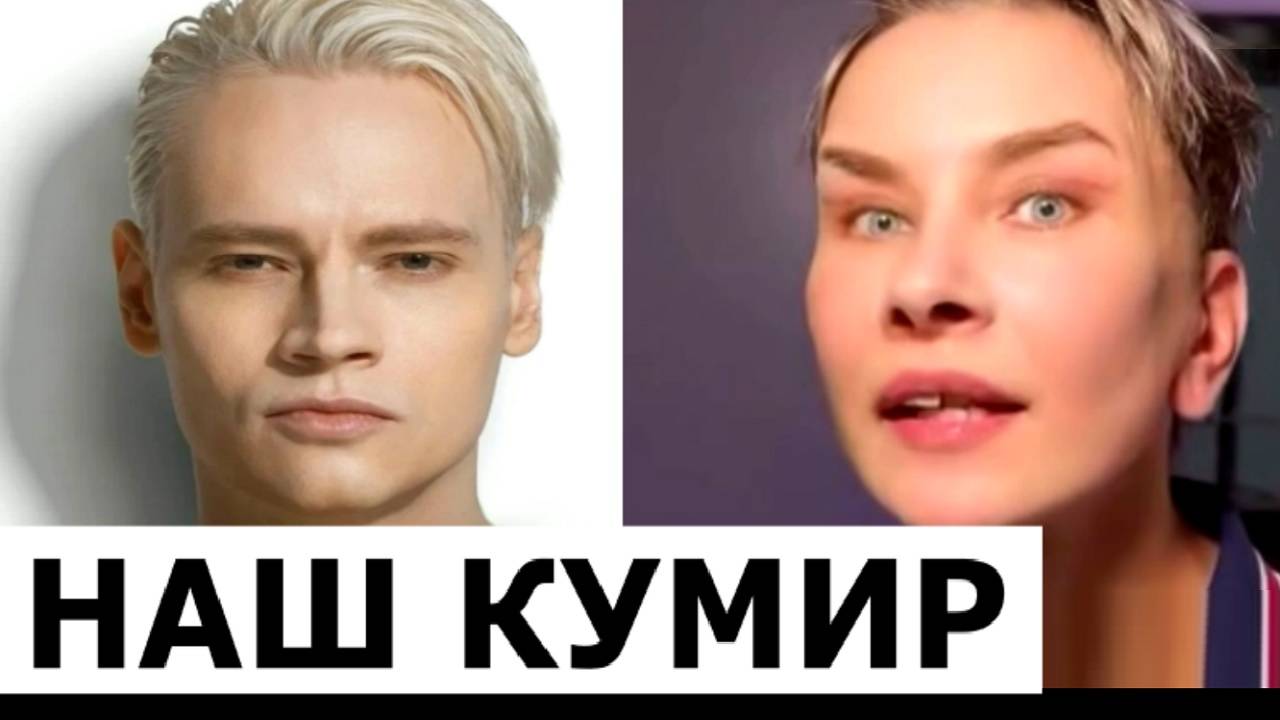 Фанатка SHAMANа сделала пластическую операцию, чтобы быть похожей на певца