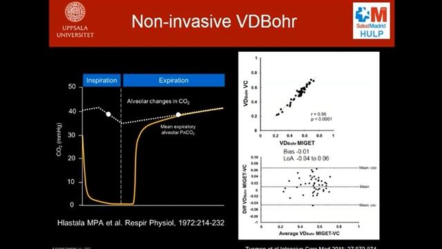 4 Gas exchange VD_VT Sipmann Fernando (ARF-18)