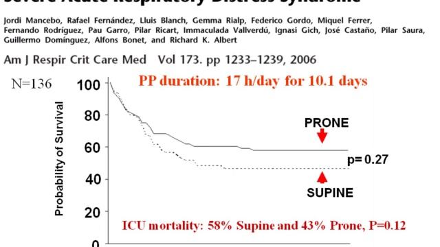 Prone position is “prone to failure” con Brochard Laurent 2011