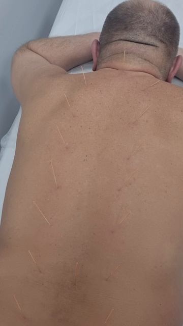 боль в спине. лечение.