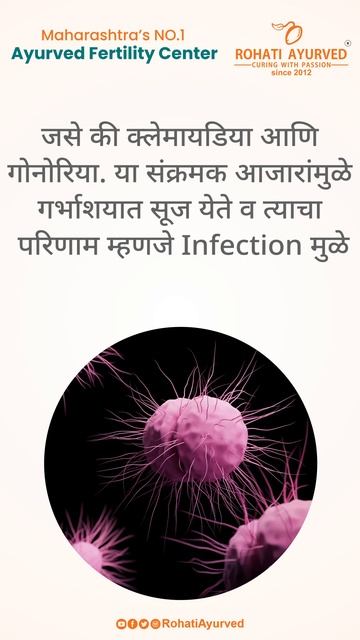 #Fallopiantube deformity -  बीज वाहिनी विकृती #Fallopiantubeblock  #RohatiAyurved