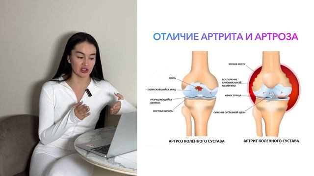 Суставы