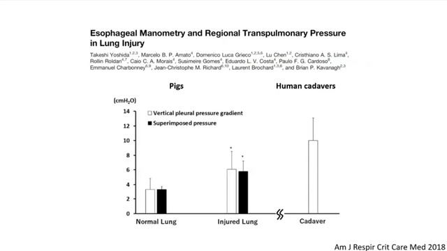 Esophageal pressure we measure Brochard Laurent 2018