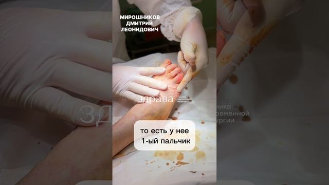 коррекция стопы