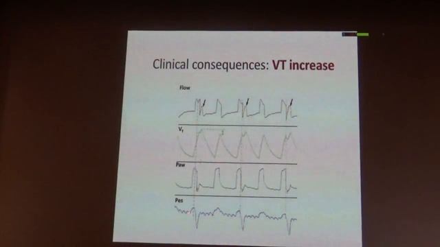 Dyssynchrony, reverse triggering and breath stacking are frequent Laurent Brocha