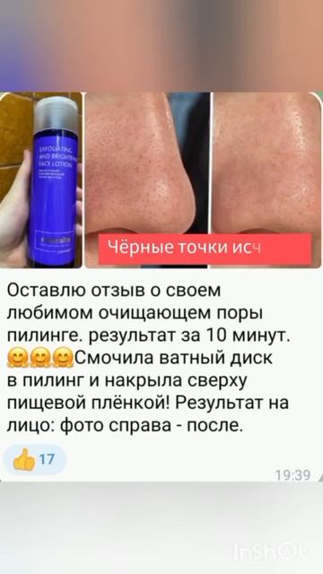 Черные точки пропали #siberianwellness #черныеточки  #сибирскоездоровье #shorts  #очищениекожи