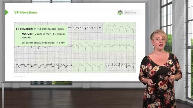 1.02 Acute Coronary Syndromes (ACS)- Treatment and Assessment