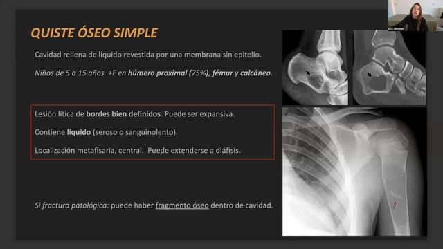 533- Lesiones óseas que no hay que tocar. Curso de Radiologia Esencial