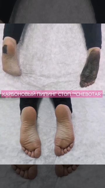 КАРБОНОВЫЙ ПИЛИНГ СТОП ™CHEBOTAR' | АППАРАТНАЯ КОРРЕКЦИЯ ЛИЦА И ТЕЛА ЭЖВА